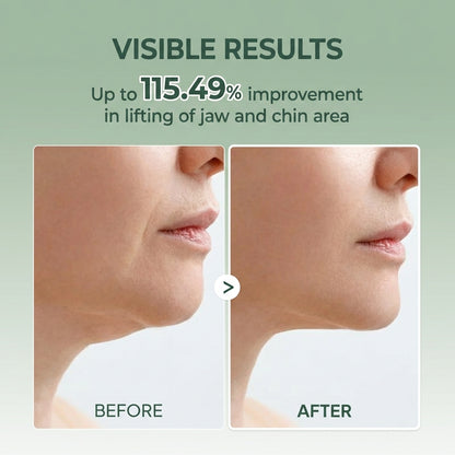 Solis Skin Facial Sculpt Band